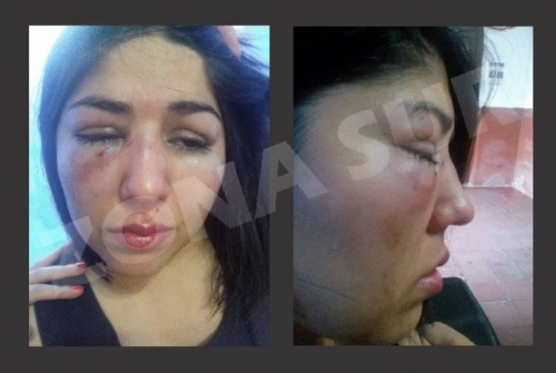 Joven fue salvajemente agredida por su ex pareja