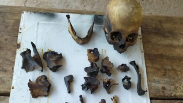Pertenecerían a un hombre los restos óseos encontrados en finca San Antonio