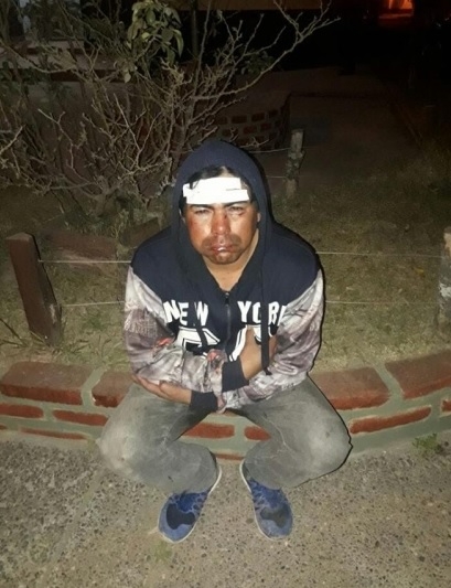 Un policía y otro sujeto detenidos por la brutal golpiza que le propinaron a un originario