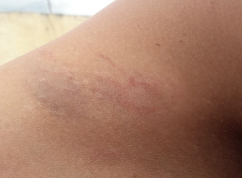 La Policía de Urtubey suma denuncias por abuso y agresiones