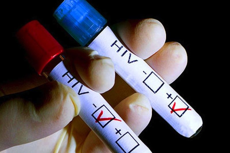 “Estamos por arriba de la media nacional en el NOA, o sea que evidentemente la enfermedad (VIH) está haciendo estragos en nuestra comunidad”