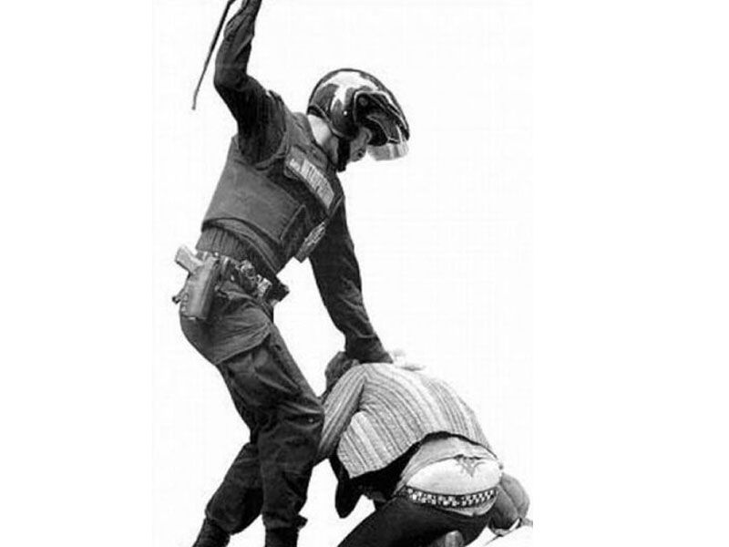 La policía le disparó a la cara, puede perder el ojo y no recibe respuestas del Estado
