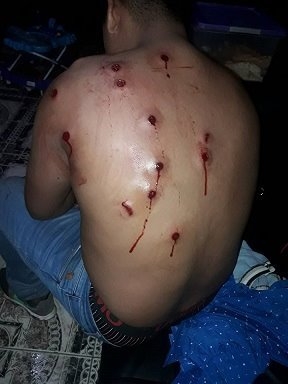 En Orán dispararon al menos 12 veces contra un motociclista y en el Valle picanearon a un menor