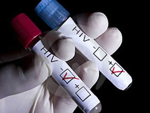 No hay reactivos para pacientes con VIH