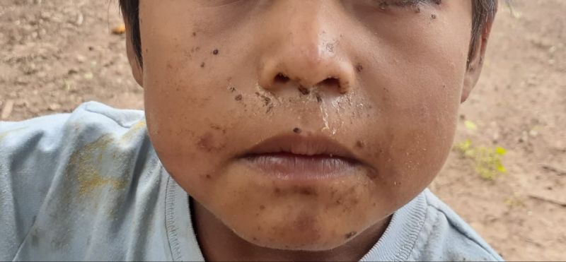 Por pobres: tres niños mueren en tres días
