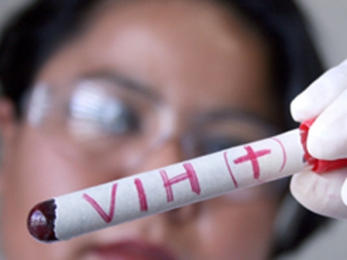 En Salta se incrementan los casos por VIH