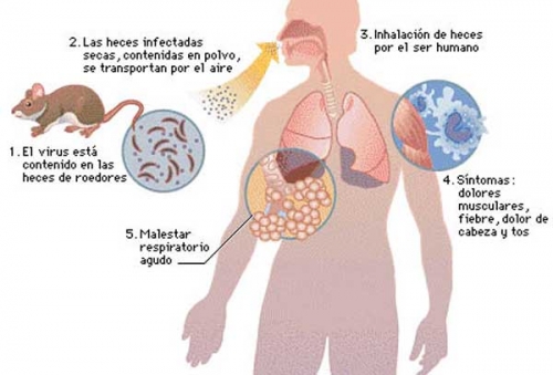 De cada 100 enfermos de hantavirus, 25 mueren en Salta