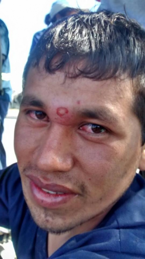 Reprimieron en el vertedero San Javier