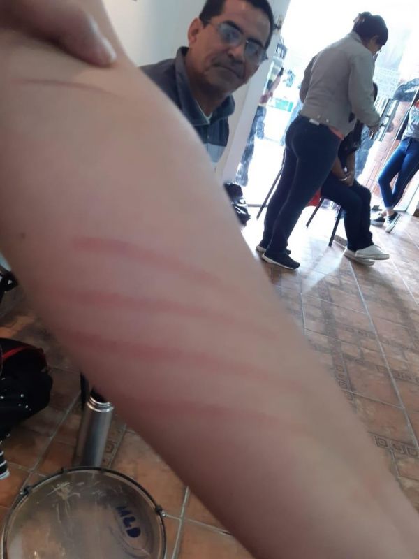 “Fue terrible ver sangrar a las compañeras por un plato de comida”