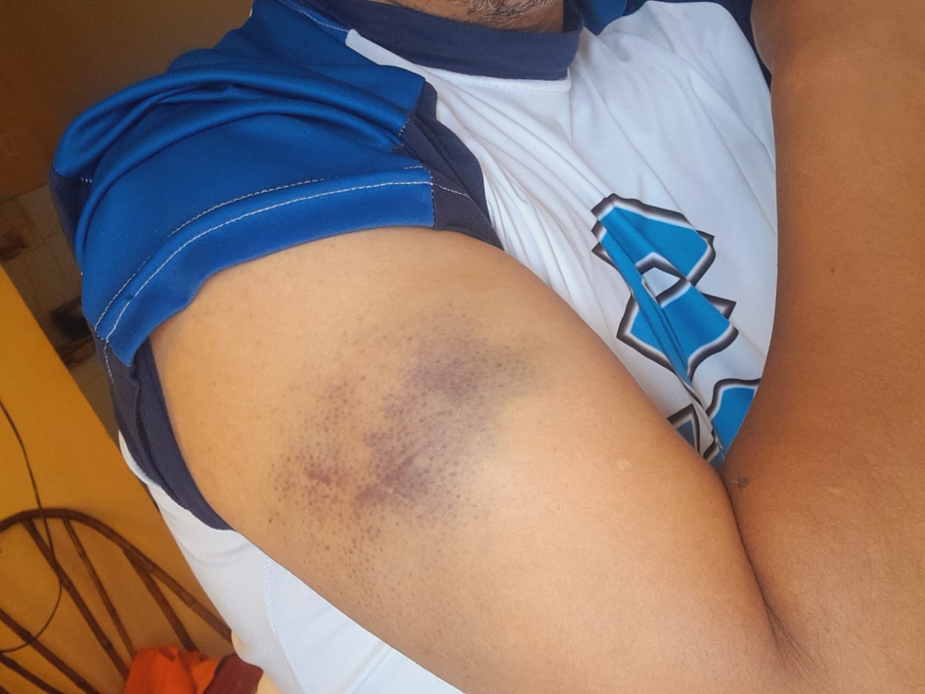 Personal de Infantería agredió al periodista Paulo Ávila