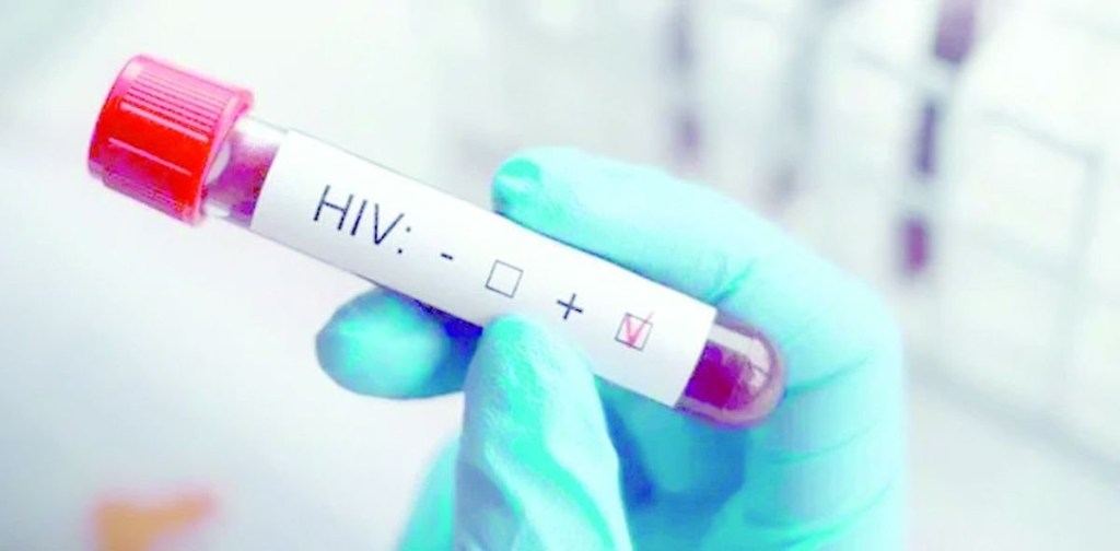 Se profundiza el ajuste en salud: Nación no enviará más reactivos para medir carga viral de VIH