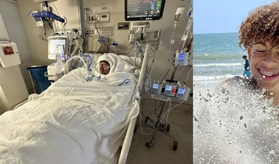 Un adolescente sufrió quemaduras en el 76% de su cuerpo por un peligroso desafío de TikTok