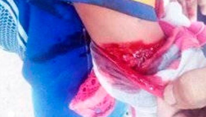 Madre atacó a sus hijos a machetazos por gastar $20
