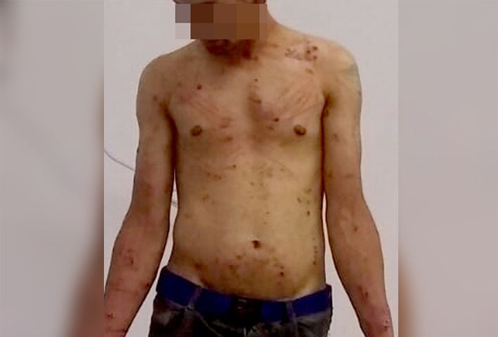 Resistencia: una mujer mordió y apuñaló a su esposo tras una noche de tragos con amigas