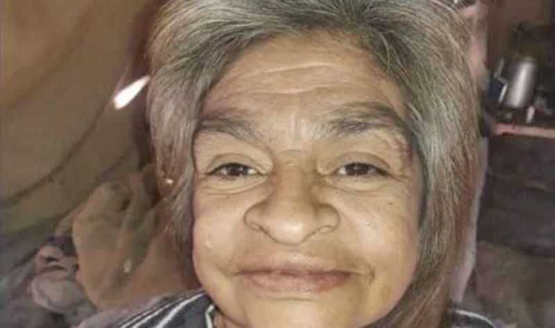 Murió la mujer con quemaduras en más del 80% de su cuerpo