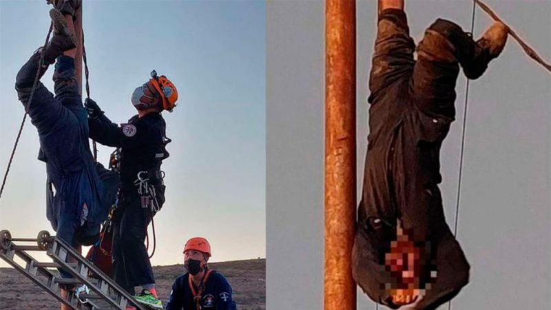 Le amputarán el brazo al hombre que se trepó a robar cables y quedó electrocutado.