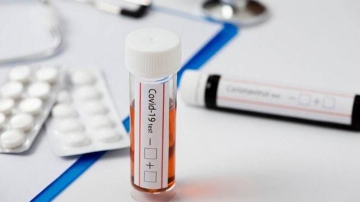 Presentaron un nuevo test rápido para detectar coronavirus en 15 minutos