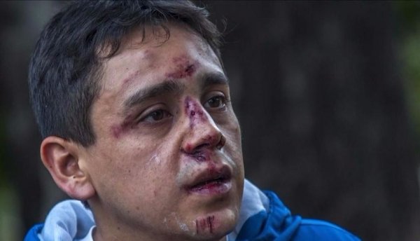Salta:Lo desfiguraron en un boliche y lo arrojaron inconsciente a la calle
