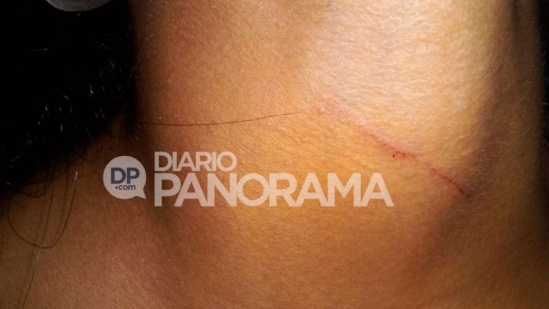 Grave caso de violencia en las aulas: le puso una trincheta en el cuello a una compañera