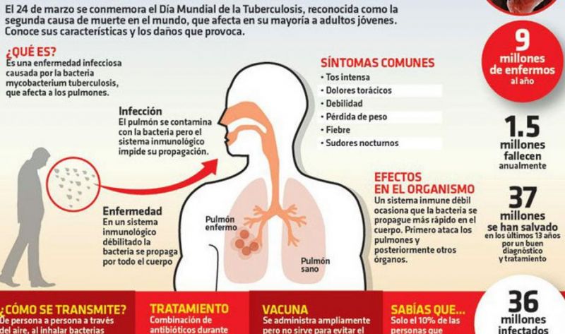 La OMS reclamó más financiación para combatir la tuberculosis