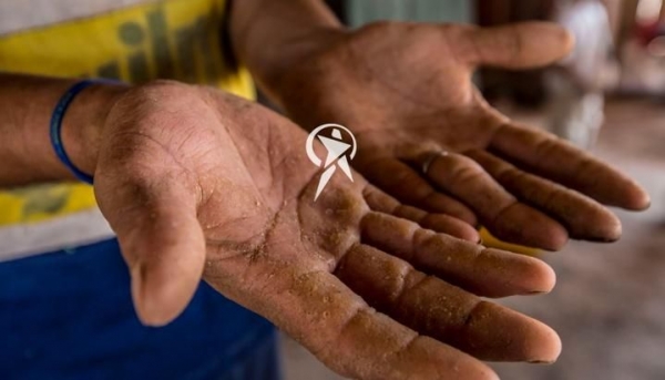 ARSÉNICO Uno de cada diez argentinos consume agua con arsénico