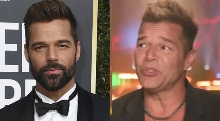 Ricky Martin vuelve a los escenarios y todos hablan de su "cara nueva"