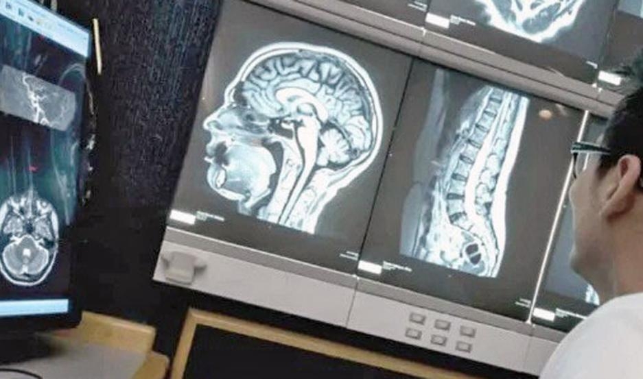 Alarma: cada día se detectan en la Argentina 5 casos de tumores cerebrales
