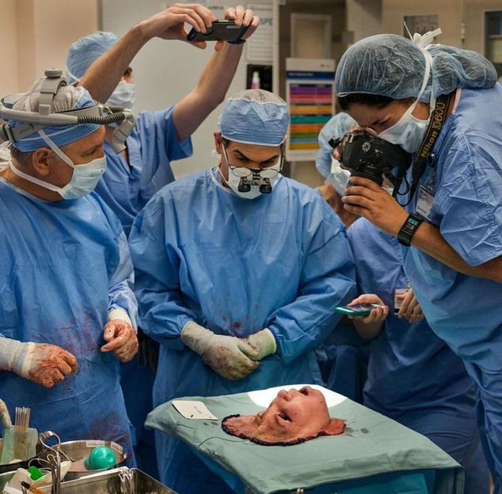 La historia detrás de la foto del trasplante de rostro de Katie Stubblefield, una de las imágenes más impactantes de la pasada década