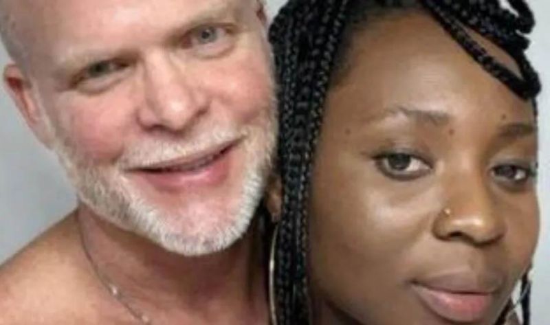 Pareja realiza una “terapia de orina” que a ella le mejora la piel y a él le crece el pelo