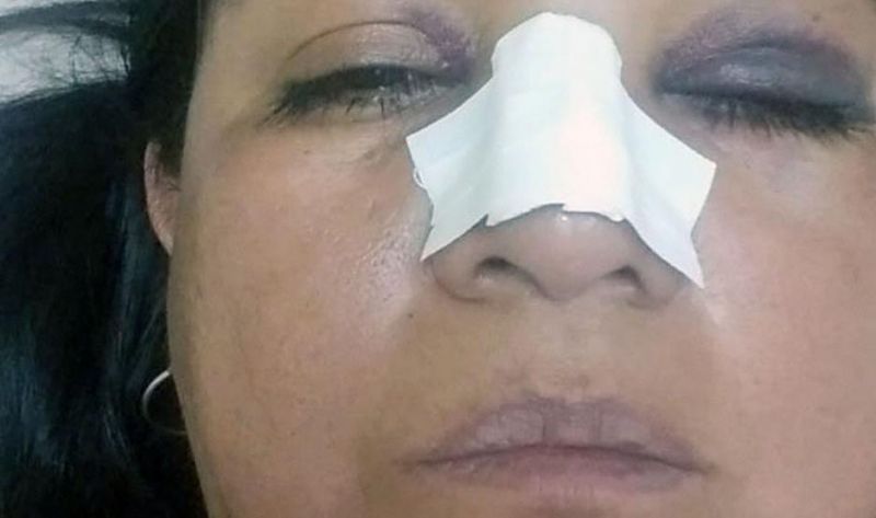 Mujer denunció que fue agredida por su hermano en “Monte”