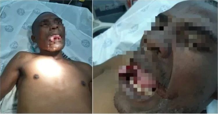 Una doctora le arrancó la lengua a un hombre cuando intentaba violarla dentro de un hospital en Sudáfrica