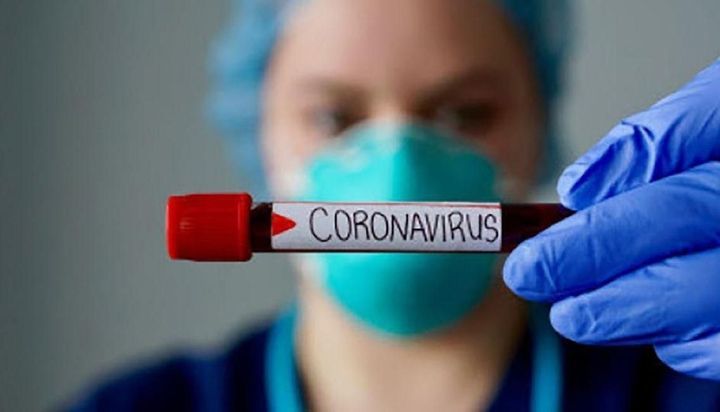 Hoy se registraron 2.439 nuevos casos en Argentina y 26 muertes en las últimas 24 horas