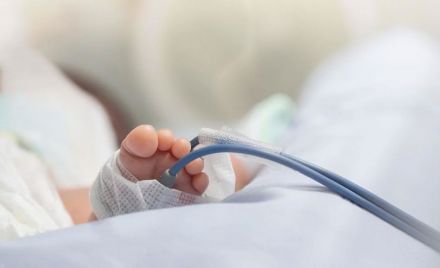 Negligencia médica: un bebé nació sin rostro