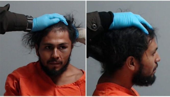 Violencia policial en EEUU: le rompieron el cuello y tuvieron que sujetarle la cabeza para la foto