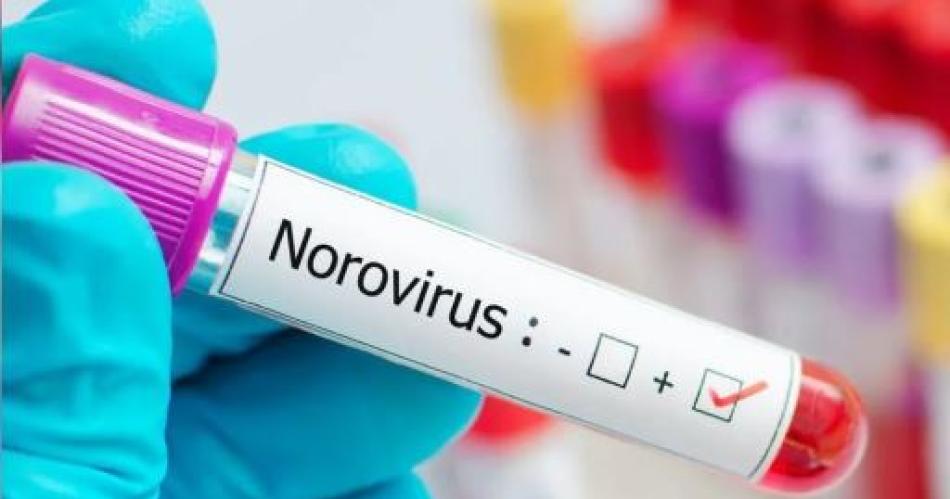 Alarma en Argentina por un brote de norovirus: qué es y cómo se contagia