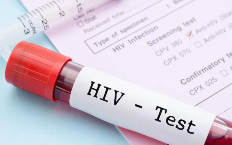Histórica condena a un hombre que contagió a su pareja con el virus del sida