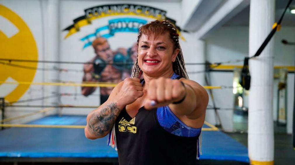 Nuevo parte médico de “Locomotora” Oliveras: revelan que el ACV le causó una lesión irreversible en el cerebro.