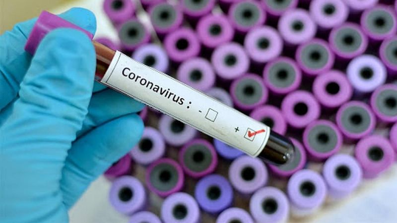 Chaco: Tercera muerte por coronavirus