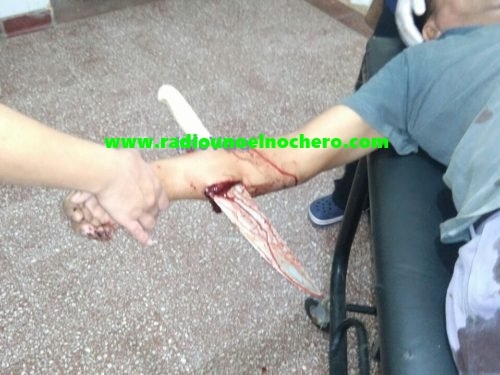 Vera: Brutal ataque a un empleado municipal