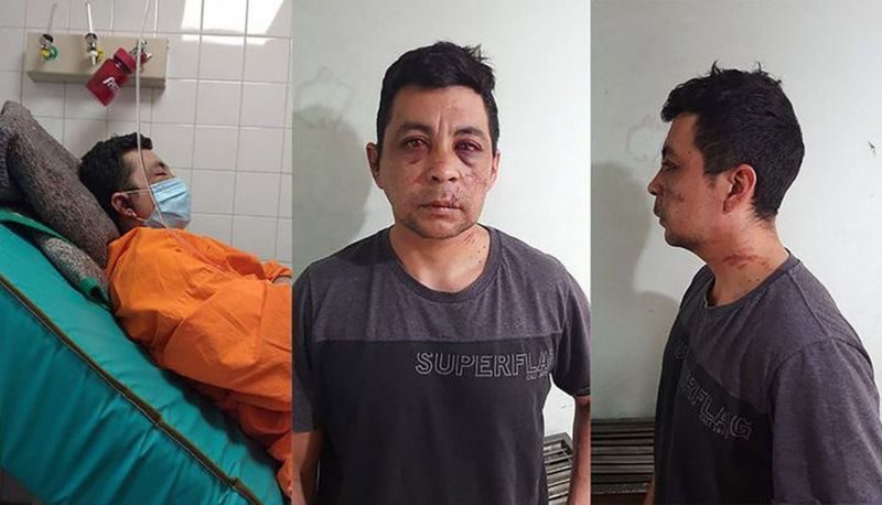 VIDEO Tuvo COVID-19, los vecinos le pegaron, le quemaron la casa y le robaron el auto