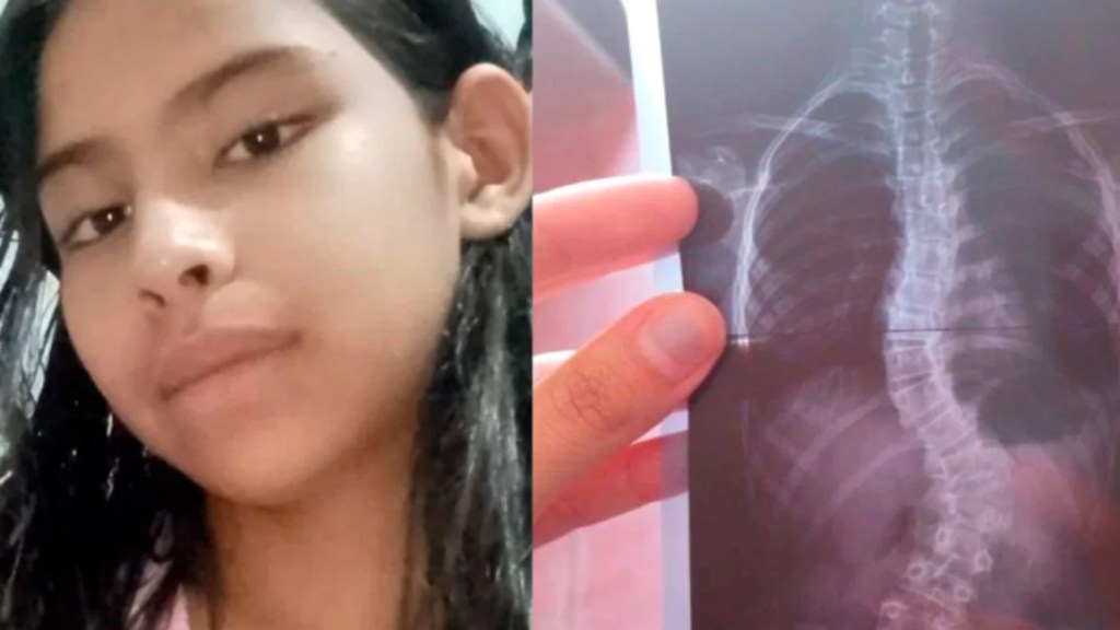 Un padre necesita ayuda para poder costear una compleja intervención quirúrgica de su hija