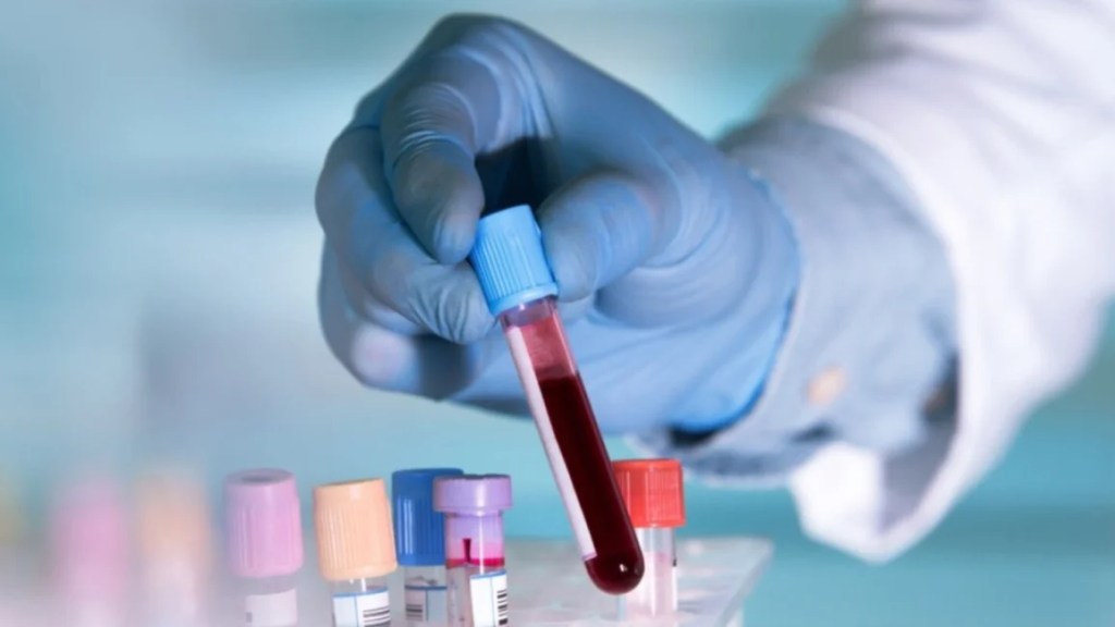 Día Mundial de la Hemofilia: un llamado a la equidad en la atención médica