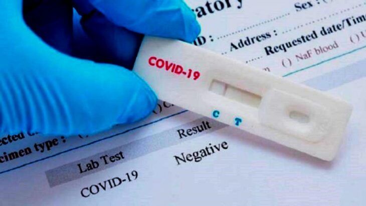 PARAGUAY – Coronavirus: Denuncian que utilizan “test truchos” para ingresar a Argentina desde Encarnación