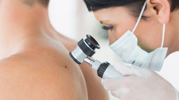 SALUD: Cáncer de piel: «la detección temprana es clave para una evolución favorable»