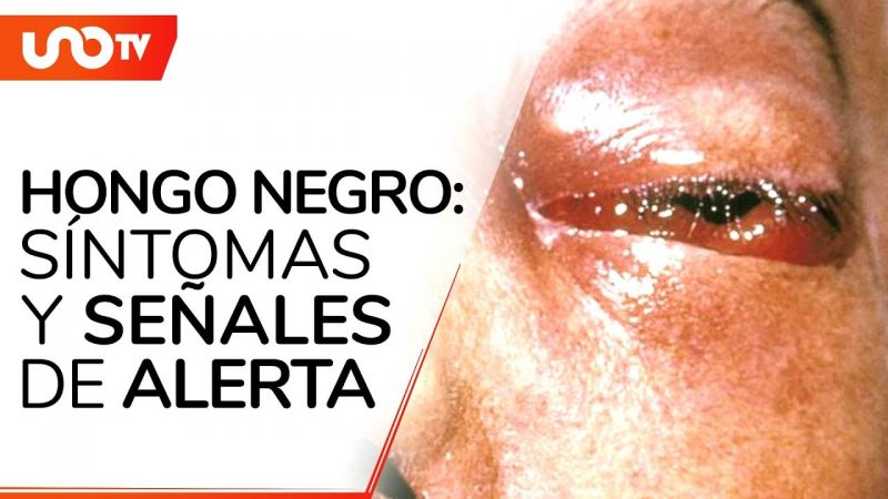 Qué es el “hongo negro”, caso asociado al COVID-19