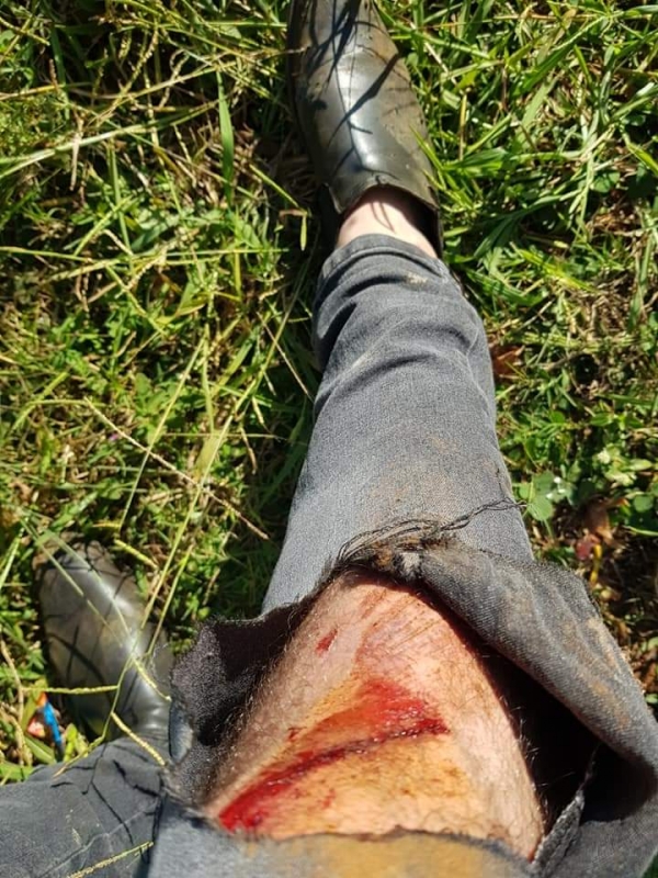 MISIONES – San Vicente: Periodista local denunció que fue atropellado por un vehículo cuando hacia notas a la salida de una fiesta clandestina