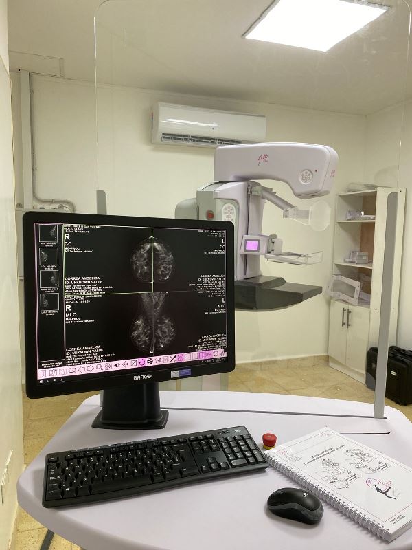 Misiones: Nuevo equipo de mamografía digital en el Hospital de San Vicente