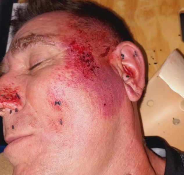 ÁRBITRO HUINQUENSE FUE ATACADO EN MACKENNA Y LO TUVIERON QUE LLEVARON TERAPIA A RIO CUARTO