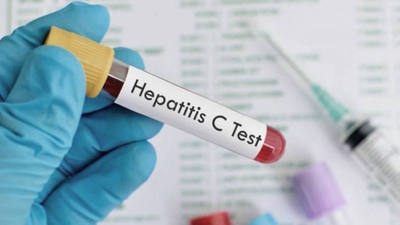HEPATITIS