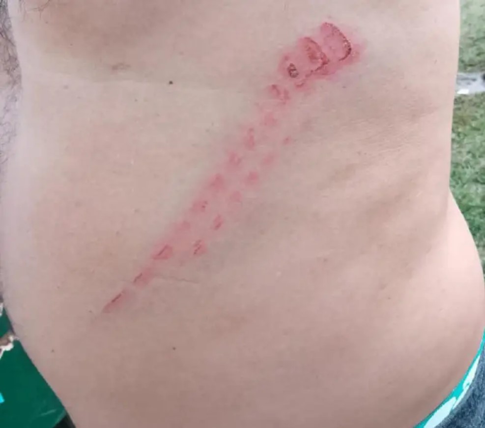 VIOLENTO ATAQUE A UN TESTIGO DE ABIGEATO EN ITATÍ